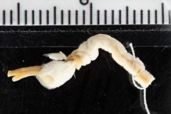 Media type: image;   Malacology 280238 Description: Digital documentation photo of preserved specimen.;